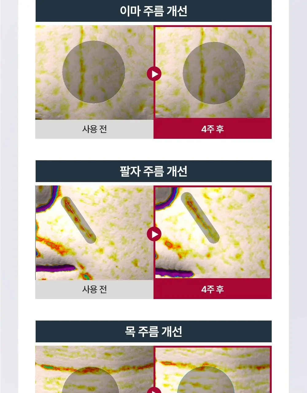 [5월 올영픽/1등 세럼] 유세린 하이알루론 에피셀린 세럼 30ml 기획 (+에피셀린 세럼 7ml*2) 상세페이지 24